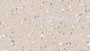 DAB staining on IHC-P; Samples: Human Cerebrum Tissue; Primary Ab: 20µg/ml Rabbit Anti-Human FASN Antibody Second Ab: 2µg/mL HRP-Linked Caprine Anti-Rabbit IgG Polyclonal Antibody