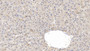 DAB staining on IHC-P; Samples: Human Liver Tissue;  Primary Ab: 20µg/ml   Rabbit Anti-Human FASN Antibody Second Ab: 2µg/mL HRP-Linked Caprine Anti-Rabbit IgG Polyclonal Antibody 