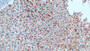 DAB staining on IHC-P; Samples: Human Liver Tissue; Primary Ab: 10µg/ml Mouse Anti-Human CTSD Antibody Second Ab: 2µg/mL HRP-Linked Caprine Anti-Mouse IgG Polyclonal Antibody