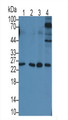 Interleukin 6 (IL6) Monoclonal Antibody, CAU30172