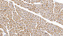 DAB staining on IHC-P; Samples: Porcine Cardiac Muscle Tissue;  Primary Ab: 20µg/ml   Mouse Anti-Porcine IL6 Antibody Second Ab: 2µg/mL HRP-Linked Caprine Anti-Mouse IgG Polyclonal Antibody 