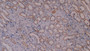 DAB staining on IHC-P; Samples: Human Kidney Tissue; Primary Ab: 10µg/ml Mouse Anti-Human KRT8 Antibody Second Ab: 2µg/mL HRP-Linked Caprine Anti-Mouse IgG Polyclonal Antibody