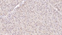 DAB staining on IHC-P; Samples: Human Liver Tissue;  Primary Ab: 10µg/ml Mouse Anti-Human SAA Antibody Second Ab: 2µg/mL HRP-Linked Caprine Anti-Mouse IgG Polyclonal Antibody 