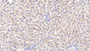 DAB staining on IHC-P; Samples: Rat Liver Tissue; Primary Ab: 10µg/ml Rabbit Anti-Rat VCAM1 Antibody Second Ab: 2µg/mL HRP-Linked Caprine Anti-Rabbit IgG Polyclonal Antibody