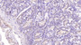 DAB staining on IHC-P; Samples: Human Small intestine Tissue;  Primary Ab: 40µg/ml Mouse Anti-Human DNAH11 Antibody Second Ab: 2µg/mL HRP-Linked Caprine Anti-Mouse IgG Polyclonal Antibody 