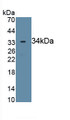 Ciliary Neurotrophic Factor Receptor (CNTFR) Polyclonal Antibody, CAU30239