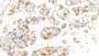 DAB staining on IHC-P; Samples: Human Placenta Tissue;  Primary Ab: 30μg/ml Mouse Anti-Human HBa1 Antibody Second Ab: 2µg/mL HRP-Linked Caprine Anti-Mouse IgG Polyclonal Antibody 