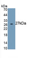 Actin Alpha 2, Smooth Muscle (ACTa2) Monoclonal Antibody, CAU30243