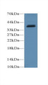 Uncoupling Protein 4, Mitochondrial (UCP4) Polyclonal Antibody, CAU30257