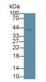 Protein Tyrosine Phosphatase Like Protein A (PTPLA) Polyclonal Antibody, CAU30262