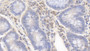 DAB staining on IHC-P; Samples: Bovine Colon Tissue; Primary Ab: 20μg/ml Rabbit Anti-Bovine IL1a Antibody Second Ab: 2µg/mL HRP-Linked Caprine Anti-Rabbit IgG Polyclonal Antibody