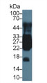 Troponin I Type 2, Fast Skeletal (TNNI2) Polyclonal Antibody, CAU30268