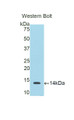 S100 Calcium Binding Protein B (S100B) Polyclonal Antibody, CAU30276