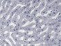 DAB staining on IHC-P; Samples: Rabbit Liver Tissue;  Primary Ab: 20µg/ml Cavia Anti-Rabbit APOC1 An