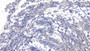 DAB staining on IHC-P; Samples: Human Small intestine Tissue;  Primary Ab: 10µg/ml Mouse Anti-Human IL17F Antibody Second Ab: 2µg/mL HRP-Linked Caprine Anti-Mouse IgG Polyclonal Antibody 