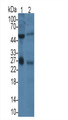 Prostate Specific Antigen (PSA) Monoclonal Antibody, CAU30328