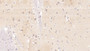 DAB staining on IHC-P; Samples: Human Cerebrum Tissue; Primary Ab: 20µg/ml Mouse Anti-Human NT-ProBNP Antibody Second Ab: 2µg/mL HRP-Linked Caprine Anti-Mouse IgG Polyclonal Antibody
