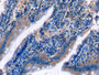 DAB staining on IHC-P; Samples: Rat Small intestine Tissue; Primary Ab: 10µg/ml Mouse Anti-Rat C5a Antibody Second Ab: 2µg/mL HRP-Linked Caprine Anti-Mouse IgG Polyclonal Antibody