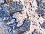 DAB staining on IHC-P; Samples: Rat Colon Tissue; Primary Ab: 10µg/ml Mouse Anti-Rat C5a Antibody Second Ab: 2µg/mL HRP-Linked Caprine Anti-Mouse IgG Polyclonal Antibody