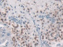 DAB staining on IHC-P; Samples: Human Liver Tissue; Primary Ab: 30µg/ml Mouse Anti-Human MIP3a Antibody Second Ab: 2µg/mL HRP-Linked Caprine Anti-Mouse IgG Polyclonal Antibody