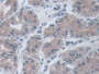 DAB staining on IHC-P; Samples: Human Stomach Tissue; Primary Ab: 30µg/ml Mouse Anti-Human IL19 Antibody Second Ab: 2µg/mL HRP-Linked Caprine Anti-Mouse IgG Polyclonal Antibody