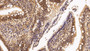 DAB staining on IHC-P; Sample: Human Small intestine Tissue; Primary Ab: 20ug/ml Mouse Anti-Human HDAC1 Antibody Second Ab: 2µg/mL HRP-Linked Caprine Anti-Mouse IgG Polyclonal Antibody