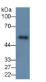 Matrix Metalloproteinase 8 (MMP8) Monoclonal Antibody, CAU30376
