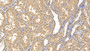 DAB staining on IHC-P; Samples: Human Kidney Tissue; Primary Ab: 20µg/ml Mouse Anti-Human MMP8 Antibody Second Ab: 2µg/mL HRP-Linked Caprine Anti-Mouse IgG Polyclonal Antibody