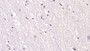 DAB staining on IHC-P; Samples: Human Cerebrum Tissue; Primary Ab: 40µg/ml Mouse Anti-Human NT3 Antibody Second Ab: 2µg/mL HRP-Linked Caprine Anti-Mouse IgG Polyclonal Antibody