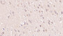 DAB staining on IHC-P; Samples: Human Cerebrum Tissue;  Primary Ab: 40µg/ml Mouse Anti-Human MOG Antibody Second Ab: 2µg/mL HRP-Linked Caprine Anti-Mouse IgG Polyclonal Antibody 