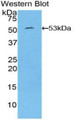 Interleukin 6 (IL6) Polyclonal Antibody, CAU30387