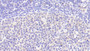DAB staining on IHC-P; Samples: Human Lymph node Tissue; Primary Ab: 20μg/ml Rabbit Anti-Human IL6 Antibody Second Ab: 2µg/mL HRP-Linked Caprine Anti-Rabbit IgG Polyclonal Antibody