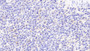 DAB staining on IHC-P; Samples: Human Spleen Tissue;  Primary Ab: 20μg/ml Rabbit Anti-Human IL6 Antibody Second Ab: 2µg/mL HRP-Linked Caprine Anti-Rabbit IgG Polyclonal Antibody 