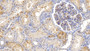 DAB staining on IHC-P; Samples: Human Kidney Tissue; Primary Ab: 10µg/ml Mouse Anti-Human FTH Antibody Second Ab: 2µg/mL HRP-Linked Caprine Anti-Mouse IgG Polyclonal Antibody