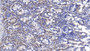 DAB staining on IHC-P; Samples: Human Small intestine Tissue;  Primary Ab: 40µg/ml Mouse Anti-Human ERLIN2 Antibody Second Ab: 2µg/mL HRP-Linked Caprine Anti-Mouse IgG Polyclonal Antibody 