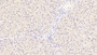 DAB staining on IHC-P; Samples: Human Liver Tissue;  Primary Ab: 30μg/ml Mouse Anti-Human ST2 Antibody Second Ab: 2µg/mL HRP-Linked Caprine Anti-Mouse IgG Polyclonal Antibody 