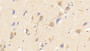 DAB staining on IHC-P; Samples: Human Cerebrum Tissue; Primary Ab: 30μg/ml Mouse Anti-Human SIGLEC8 Antibody Second Ab: 2µg/mL HRP-Linked Caprine Anti-Mouse IgG Polyclonal Antibody