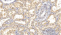 DAB staining on IHC-P; Samples: Human Kidney Tissue; Primary Ab: 10µg/ml Mouse Anti-Human IFNa21 Antibody Second Ab: 2µg/mL HRP-Linked Caprine Anti-Mouse IgG Polyclonal Antibody