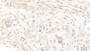 DAB staining on IHC-P; Samples: Human Placenta Tissue; Primary Ab: 10µg/ml Mouse Anti-Human GPC3 Antibody Second Ab: 2µg/mL HRP-Linked Caprine Anti-Mouse IgG Polyclonal Antibody