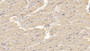 DAB staining on IHC-P; Samples: Human Small intestine Tissue;  Primary Ab: 10µg/ml Mouse Anti-Human GPC3 Antibody Second Ab: 2µg/mL HRP-Linked Caprine Anti-Mouse IgG Polyclonal Antibody 