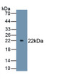 Interleukin 6 (IL6) Polyclonal Antibody, CAU30440