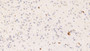 DAB staining on IHC-P; Samples: Rat Cerebrum Tissue; Primary Ab: 10ug/ml Mouse Anti-Rat HRG Antibody Second Ab: 2µg/mL HRP-Linked Caprine Anti-Mouse IgG Polyclonal Antibody