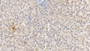 DAB staining on IHC-P; Samples: Human Liver Tissue; Primary Ab: 10µg/ml Mouse Anti-Human VF Antibody Second Ab: 2µg/mL HRP-Linked Caprine Anti-Mouse IgG Polyclonal Antibody