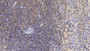 DAB staining on IHC-P; Samples: Human Spleen Tissue; Primary Ab: 10µg/ml Mouse Anti-Human VF Antibody Second Ab: 2µg/mL HRP-Linked Caprine Anti-Mouse IgG Polyclonal Antibody