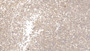 DAB staining on IHC-P; Samples: Human Lymphoma Tissue; Primary Ab: 10µg/ml Mouse Anti-Human CD4 Antibody Second Ab: 2µg/mL HRP-Linked Caprine Anti-Mouse IgG Polyclonal Antibody
