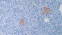 DAB staining on IHC-P; Samples: Human Pancreas Tissue;  Primary Ab: 30µg/ml Mouse Anti-Human CAMP Antibody Second Ab: 2µg/mL HRP-Linked Caprine Anti-Mouse IgG Polyclonal Antibody 