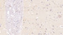 DAB staining on IHC-P; Samples: Human Cerebrum Tissue; Primary Ab: 20µg/ml Mouse Anti-Human Ub Antibody Second Ab: 2µg/mL HRP-Linked Caprine Anti-Mouse IgG Polyclonal Antibody
