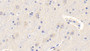 DAB staining on IHC-P; Samples: Human Cerebrum Tissue; Primary Ab: 20μg/ml Mouse Anti-Human LEP Antibody Second Ab: 2µg/mL HRP-Linked Caprine Anti-Mouse IgG Polyclonal Antibody