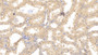 DAB staining on IHC-P; Samples: Human Kidney Tissue;  Primary Ab: 10µg/ml Mouse Anti-Human HIF1a Antibody Second Ab: 2µg/mL HRP-Linked Caprine Anti-Mouse IgG Polyclonal Antibody 