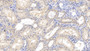 DAB staining on IHC-P; Samples: Human Kidney Tissue; Primary Ab: 10µg/ml Mouse Anti-Human EGFR2 Antibody Second Ab: 2µg/mL HRP-Linked Caprine Anti-Mouse IgG Polyclonal Antibody